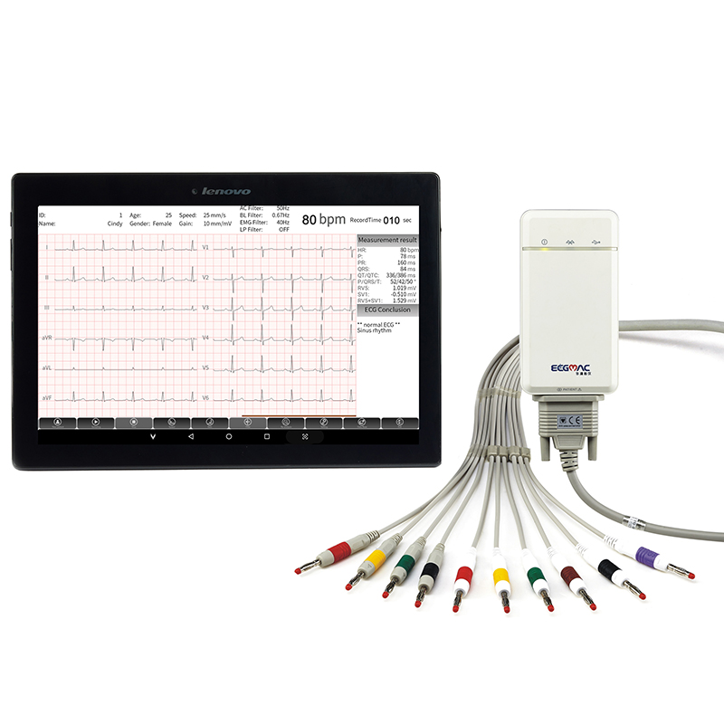 Ecgmac PE-1204 Bluetooth ЭКГ 12 каналов