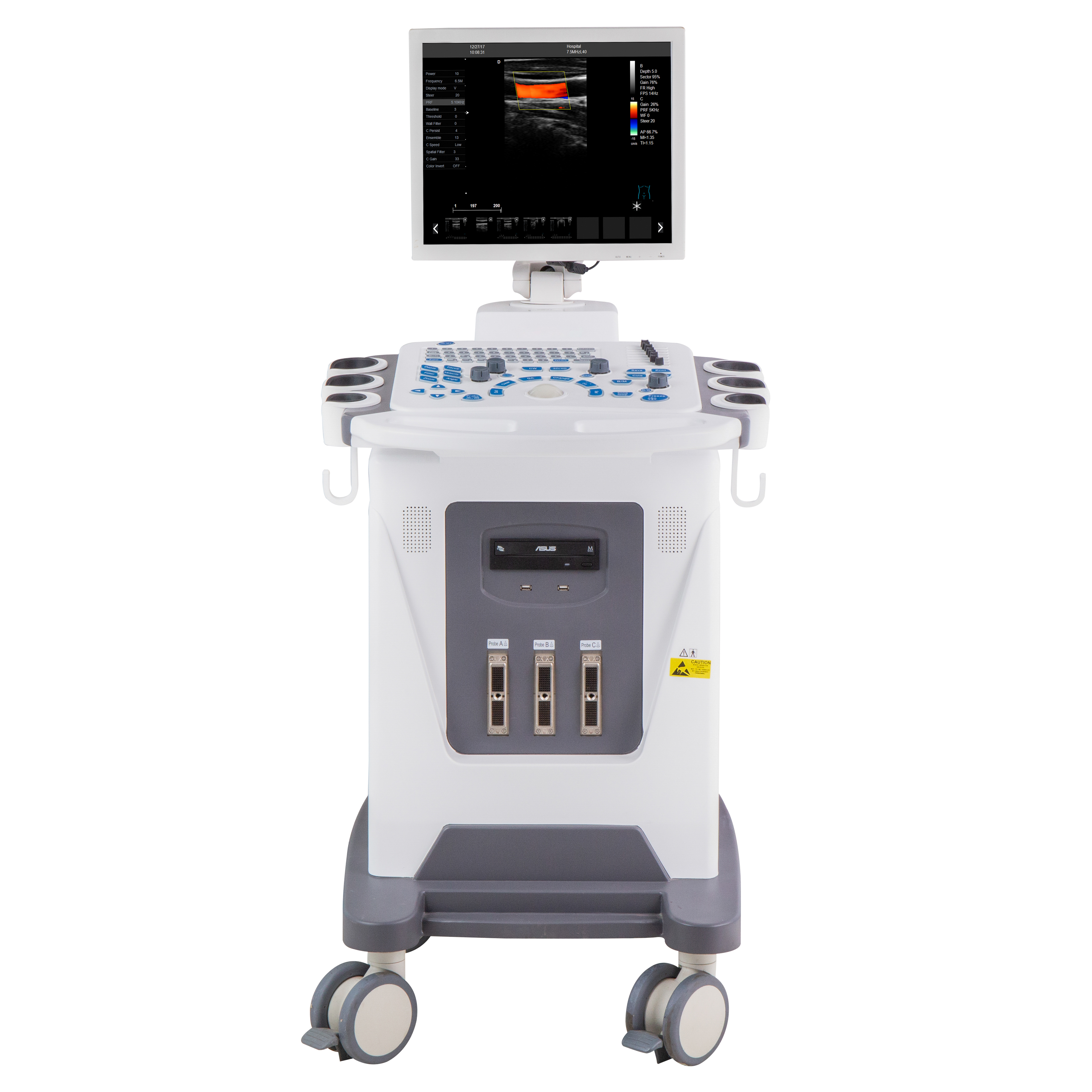 DW-F3 17 inch LED Monitor Medical Ultrasound Instruments Trolley 2D Color Doppler Ultrasound Machine