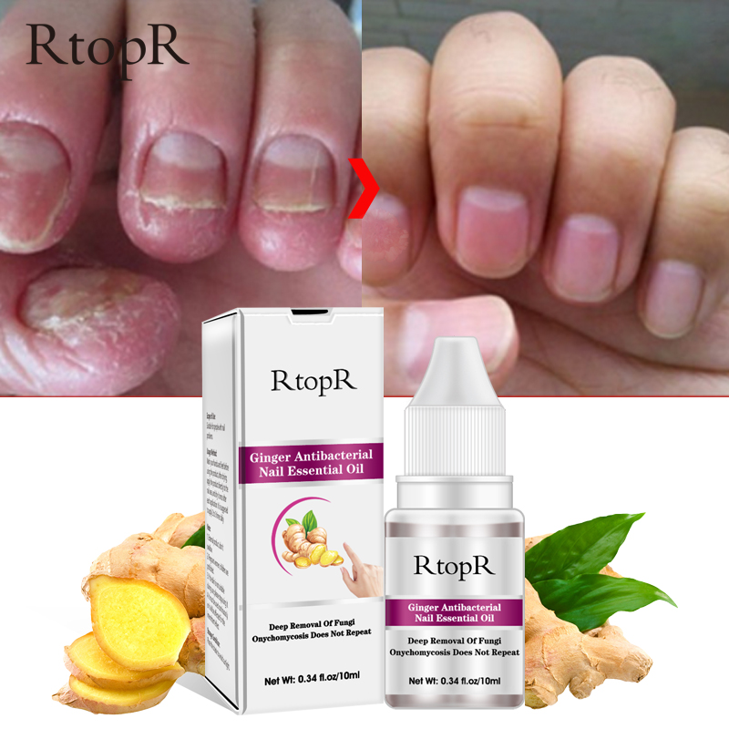 Антибактериальное масло для ногтей RtopR Ginger, лечение кутикулы, инфекционное Масло для кутикулы пальцев ногтей, восстанавливающее масло для ногтей