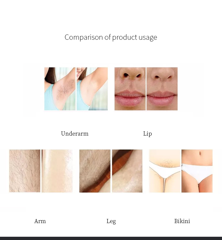 best beauty salon diode laser permanent hair removal machine 3 waves 755 808 1064nm diode laser hair removal
