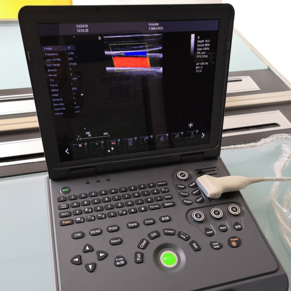 High definition portable color doppler ultrasound machine