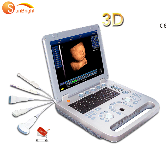 Top Quality Ultra Sound Equipment Ultrasound Machine Portable Ultrasound Machine