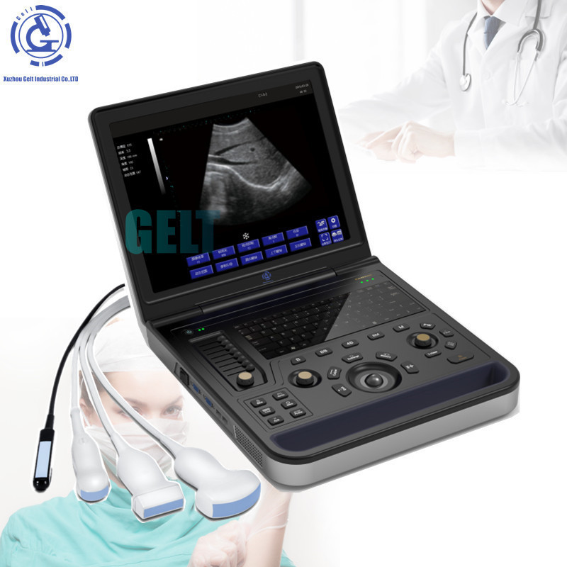 Electric Medical Ultrasound Instruments echocardiography ecografo portability ultrasonido portable ultrasound machine