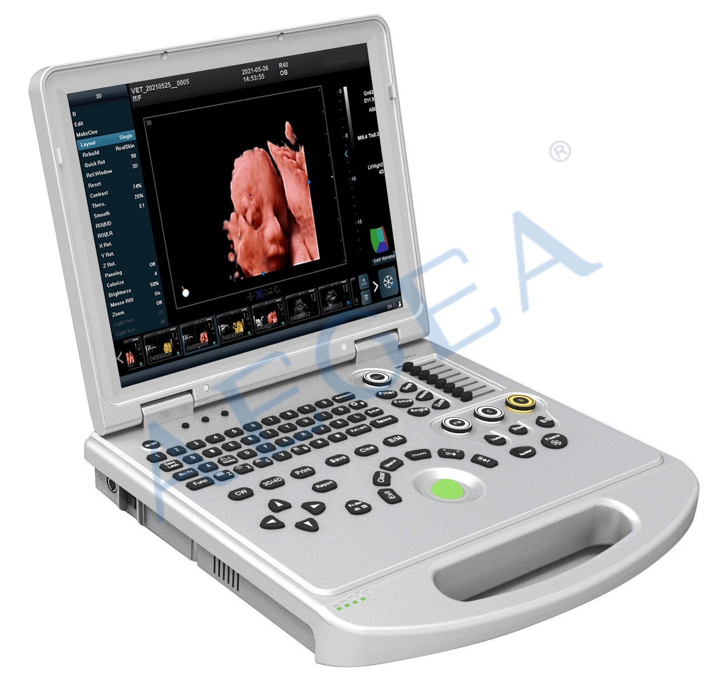 AG-L5Pro 3d portable notebook scanner Pro laptop color doppler ultrasound machine price for sale