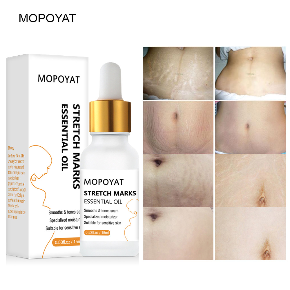 Skincare Products Firming Smoothing Repair Stretch Marks Removal Essential Oil During Pregnancy Body Lotion Body Care