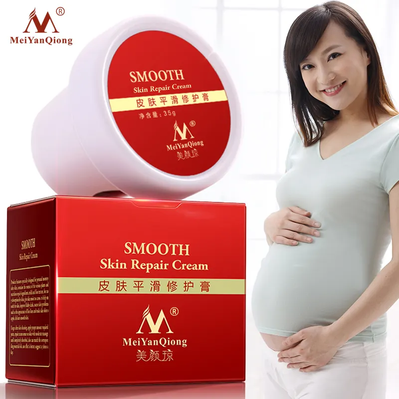 pregnant body skin care anti stretch marks scar removal Pregnancy & Scar Removal Maternity treatment Stretch Mark Cream