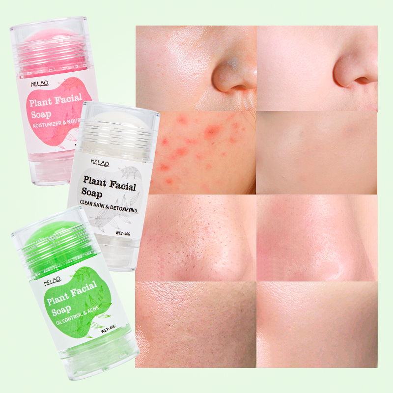 Private Label 100% Organic Natural Plant Facial Soap for Deep Cleansing Control Oil And Acne Nourish The Skin