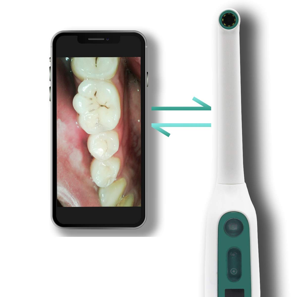 Android IOS WIFI Visual Digital Oral Mini Inspection Camera Monitor Intra Oral Scanner Dental Intraoral Camera for Teeth