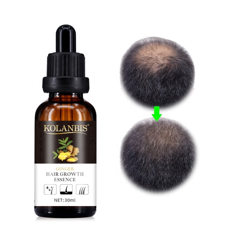 Private Label Fast Hair Grow Tonic Ginger Extract Anti Hair Loss Products 30ml
