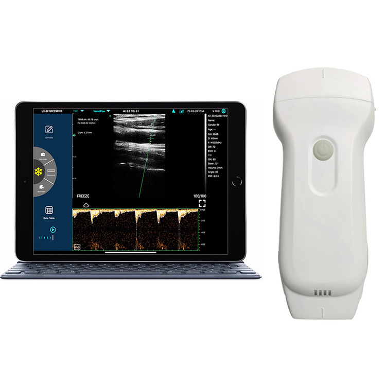Portable Veterinary Ultrasound Equipment Cow / Horse / Goat / Pig Pregnancy4d Ultrasound Scanner Echograph Machine Electric CE