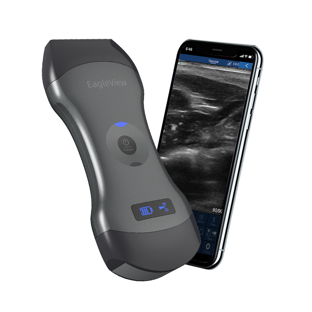 Weleaglue leview двойная головка ветеринарная ультразвуковая машина для животных