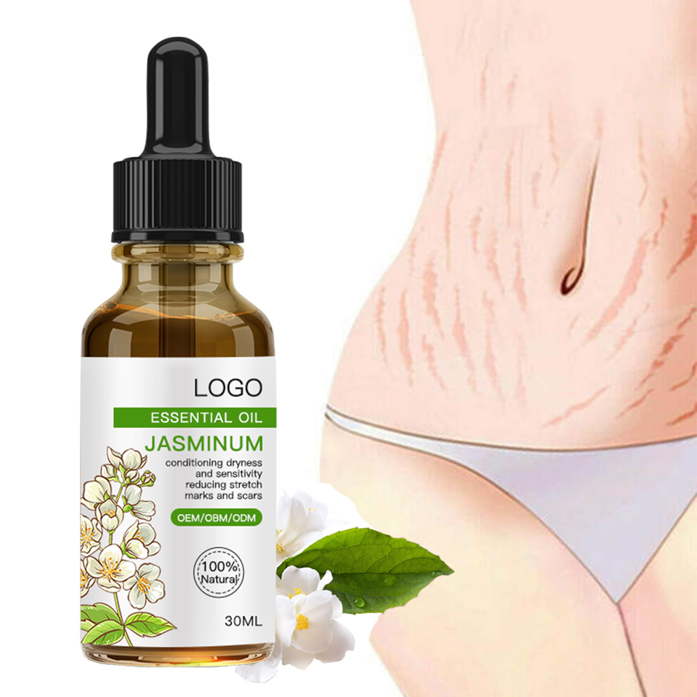 Private Label Natural Improve Skin Elasticity Body Lotion Anti Vergeture Strech Marks Removal Cream Oil