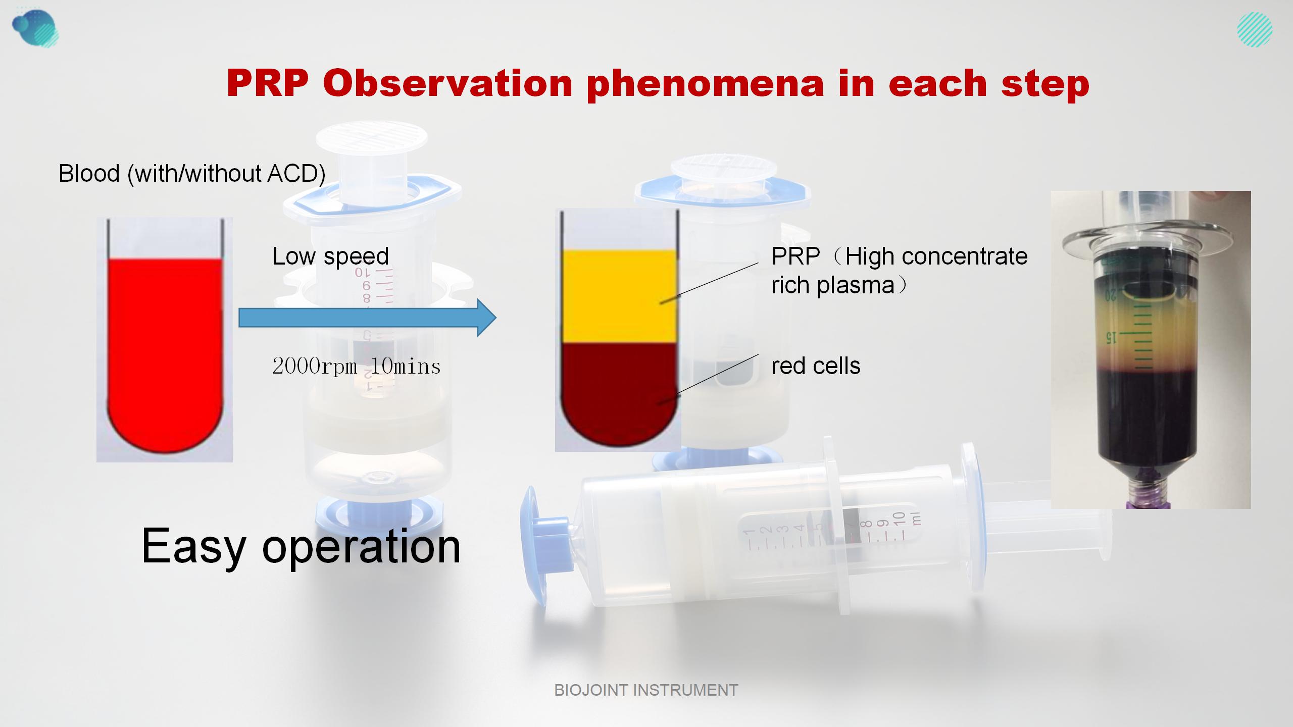 ACP-Autologous conditioned plasma kit, double syringe PRP kits centrifuge, 50ml PRP kits tabletop centrifuge