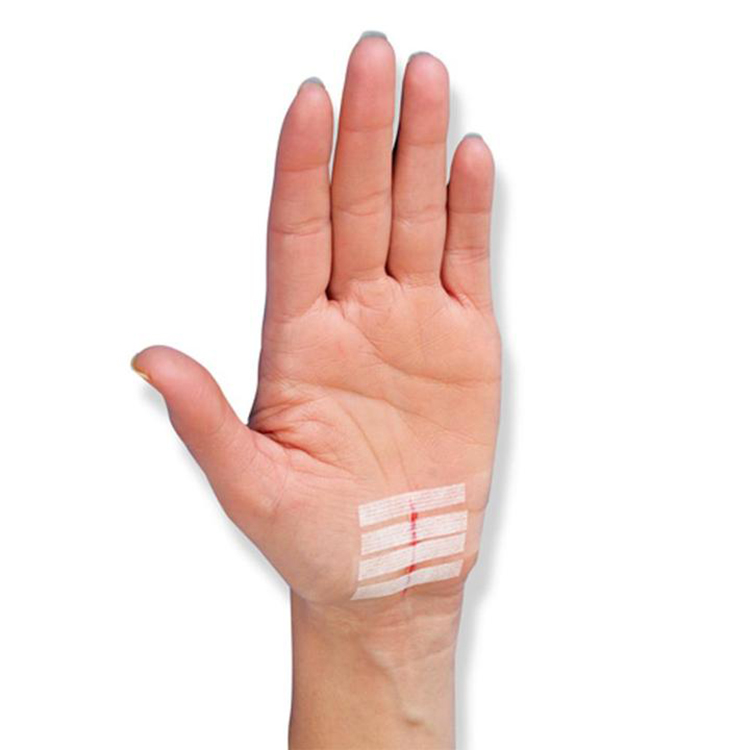 Wholesale fashionable wound skin closure strip non woven wound closure strip