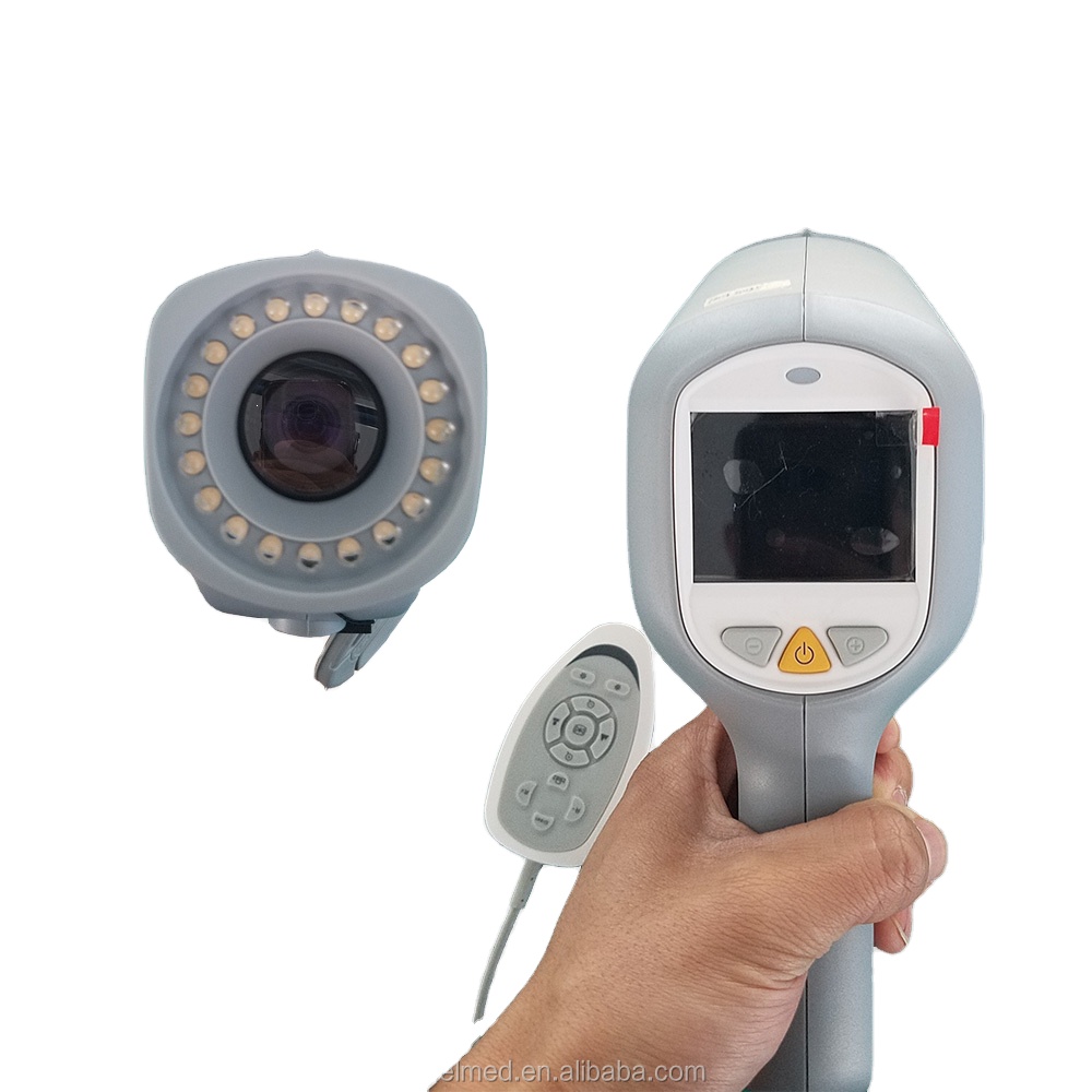 Digital Electronic Colposcope/1080p hd vagina pictures colposcope cheap price
