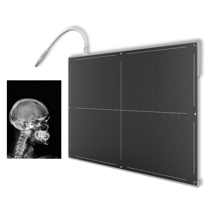 17"X14" Fix Mounted Csi Digital Medical Careray Wireless X Ray Flat Panel Detector For Human