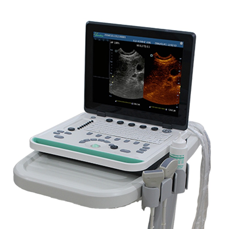 PC Based Laptop B Ultrasound Scanner Machine For Pregnancy/ OB/GYN & Urology & Cardiology