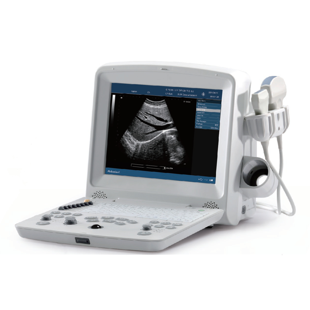 Edan DUS60 Human and Animal Portable Ultrasound Scanner Machine Black and White Vet Ultrasound Scan Cheap Price