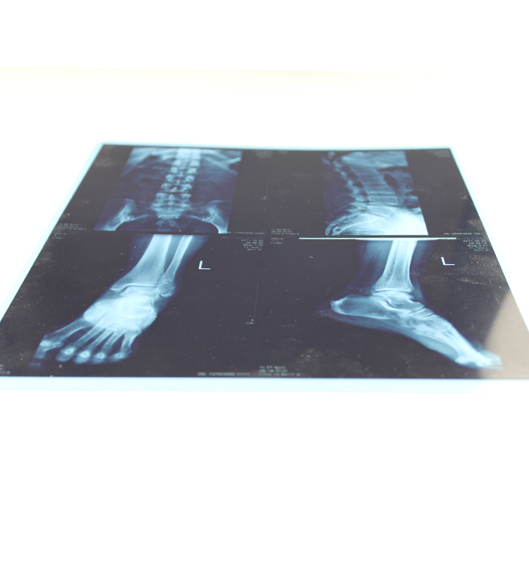 Термопленка ct scan 14x17 дюймов рентгеновская пленка CT c