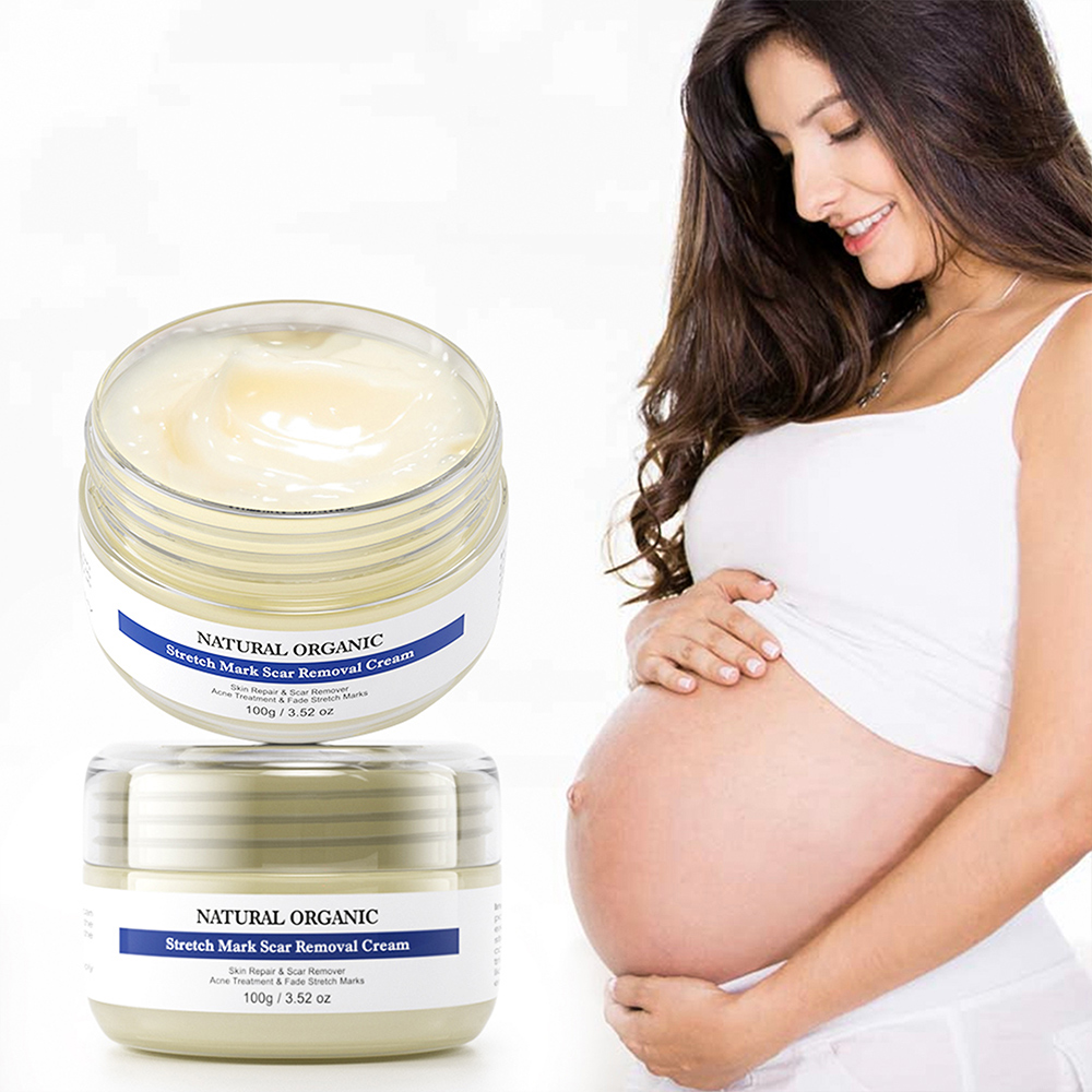 stretch mark cream natural organic stretch mark repair cream private label