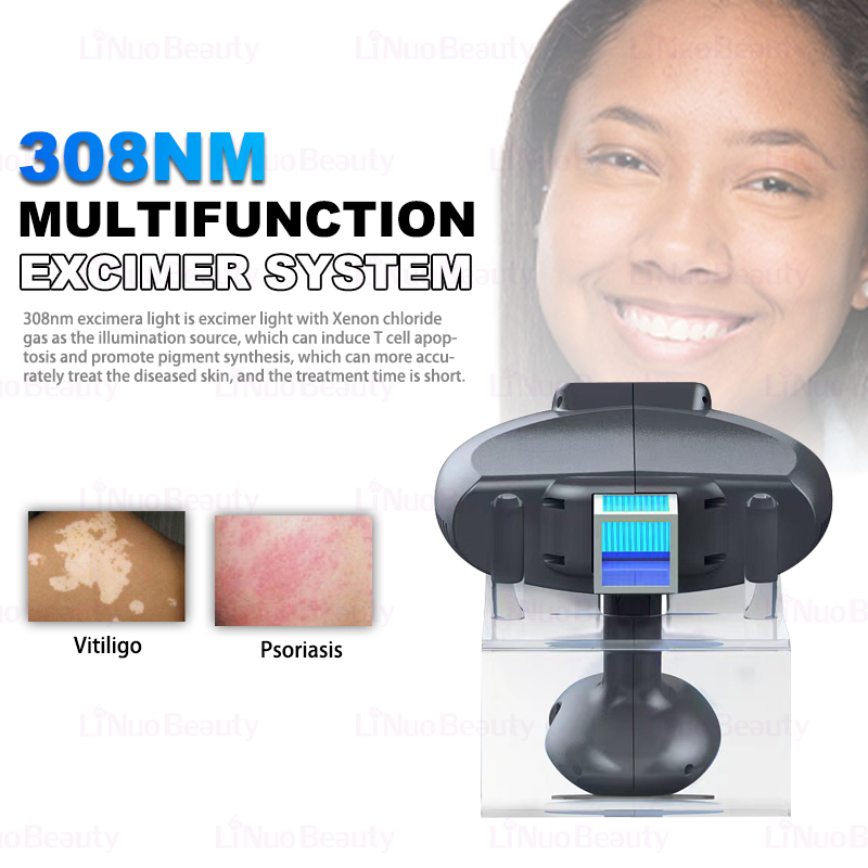 High Energy Medical 308 Nm Laser Excimer Vitiligo Device Skin Problem Ultraviolet Treatment Vitiligo Treatment Device Medical