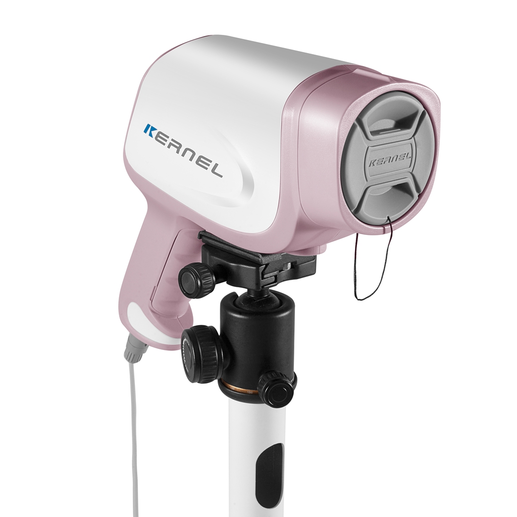 HD video colposcope camera digital camera sony colposcopy for gynecology examination in Clinic 3,270,000 pixels hospital use