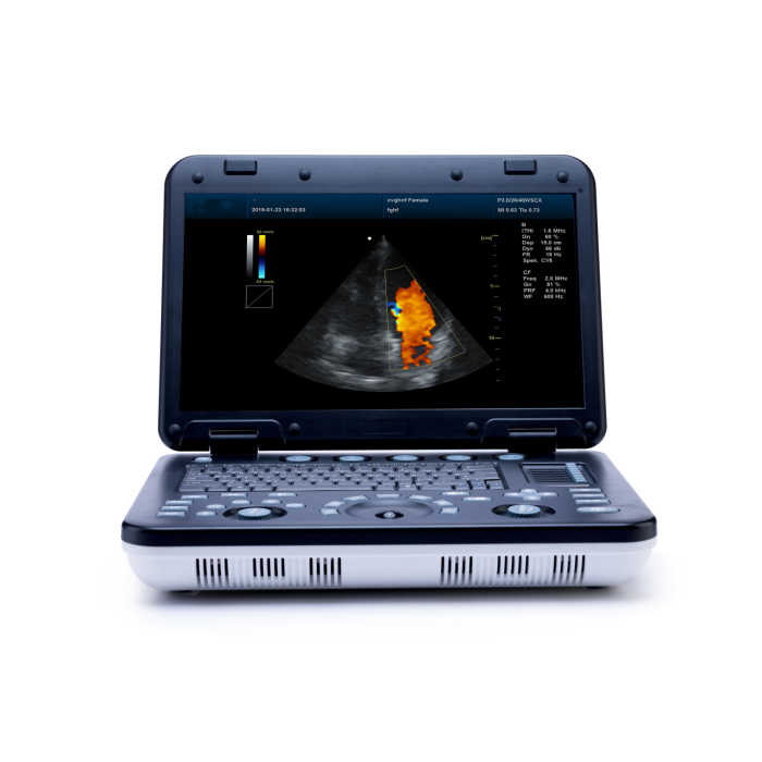 China Factory Price Color Ultrasonic Machine with Powerful 3D/4D Image Processing Technology Electric Metal Material