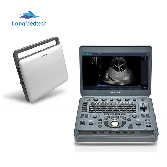 Sonoscape X3 Portab Sonoscape X3 Portable Echo Ultrasound Equipment Ultrasound Machine Price Electric Steel Medical Device