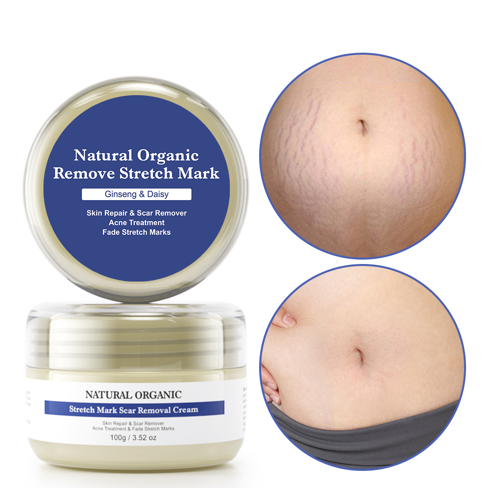 anti stretch mark cream natural quality scar and stretch marks cream private label