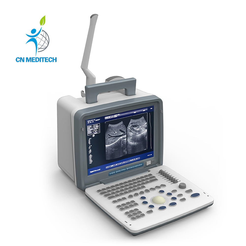 Medical Ultrasonic Equipment Full Digital Laptop Ultrasound Scanner B/W Portable Ultrasound Machine