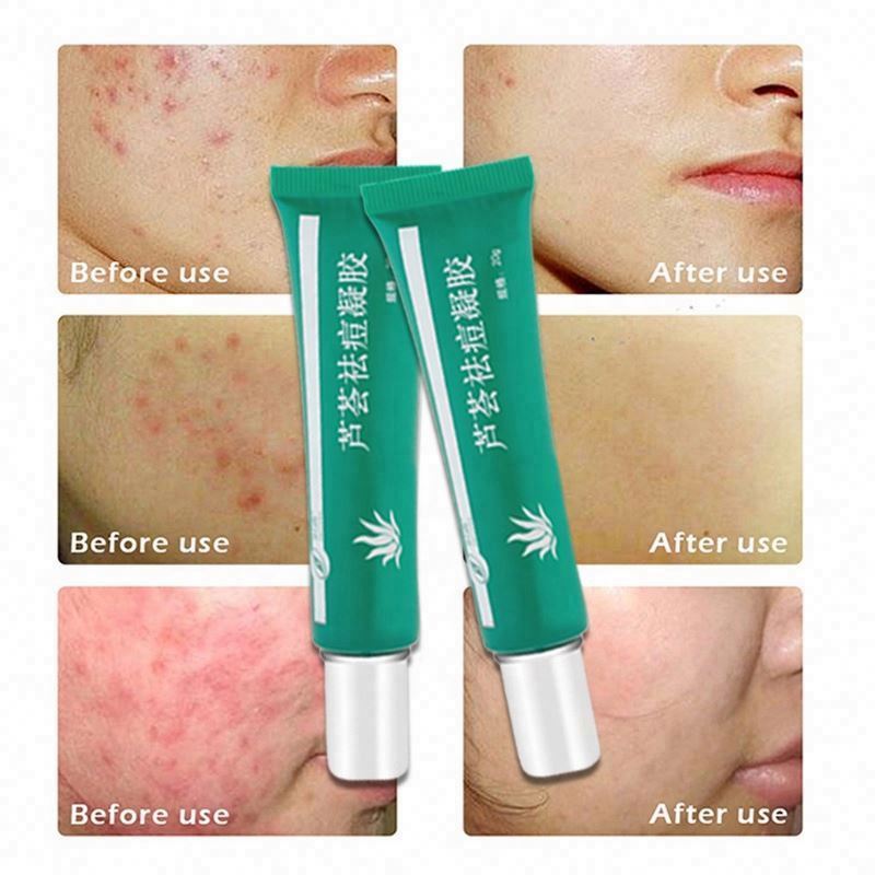 V aloe vera gel bed after bath soothing gel buy online near me