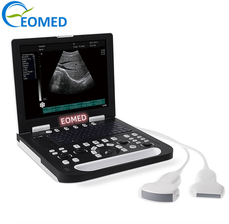 full digital laptop ultrasound system portable ultrasonic scanner best quality ultrasound sonar instruments BW22