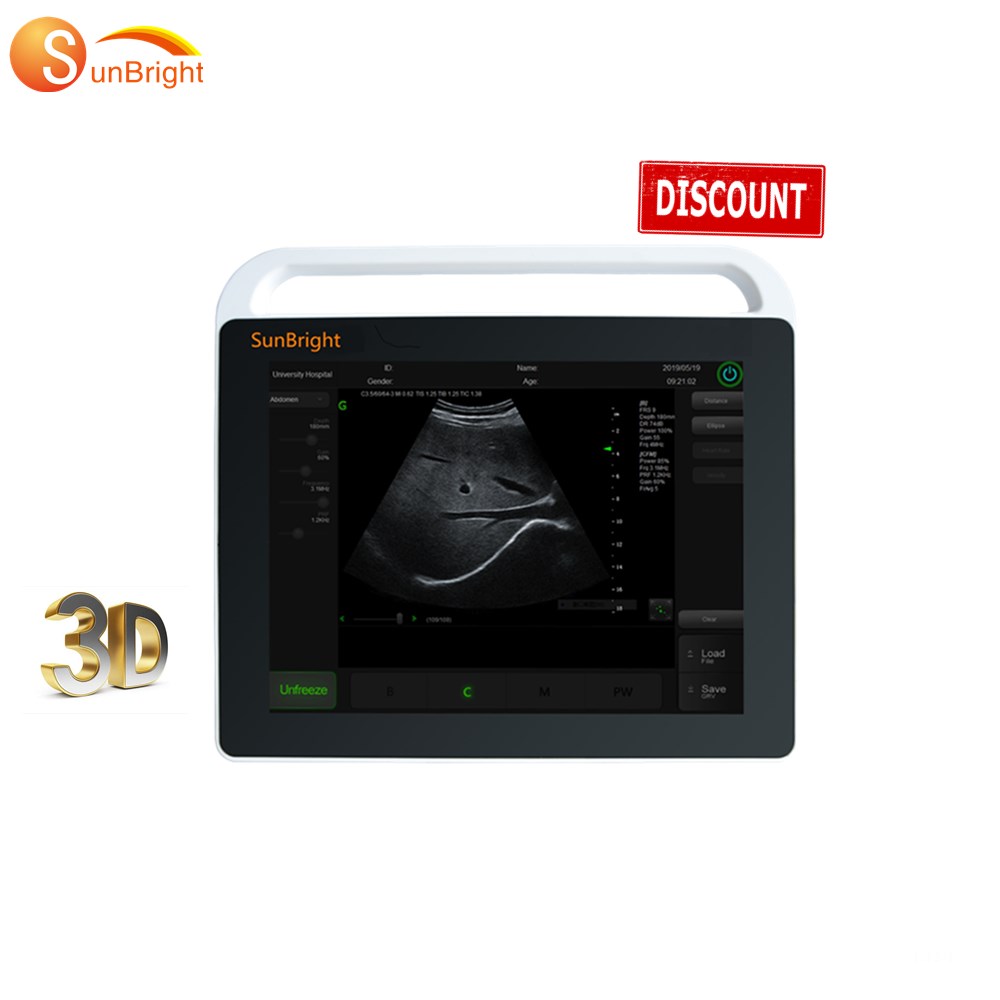 Оптовая цена, ультразвуковой аппарат для ноутбука с сенсорным экраном OB/GYN 15 дюймов, портативный ультразвуковой сканер в режиме, цена