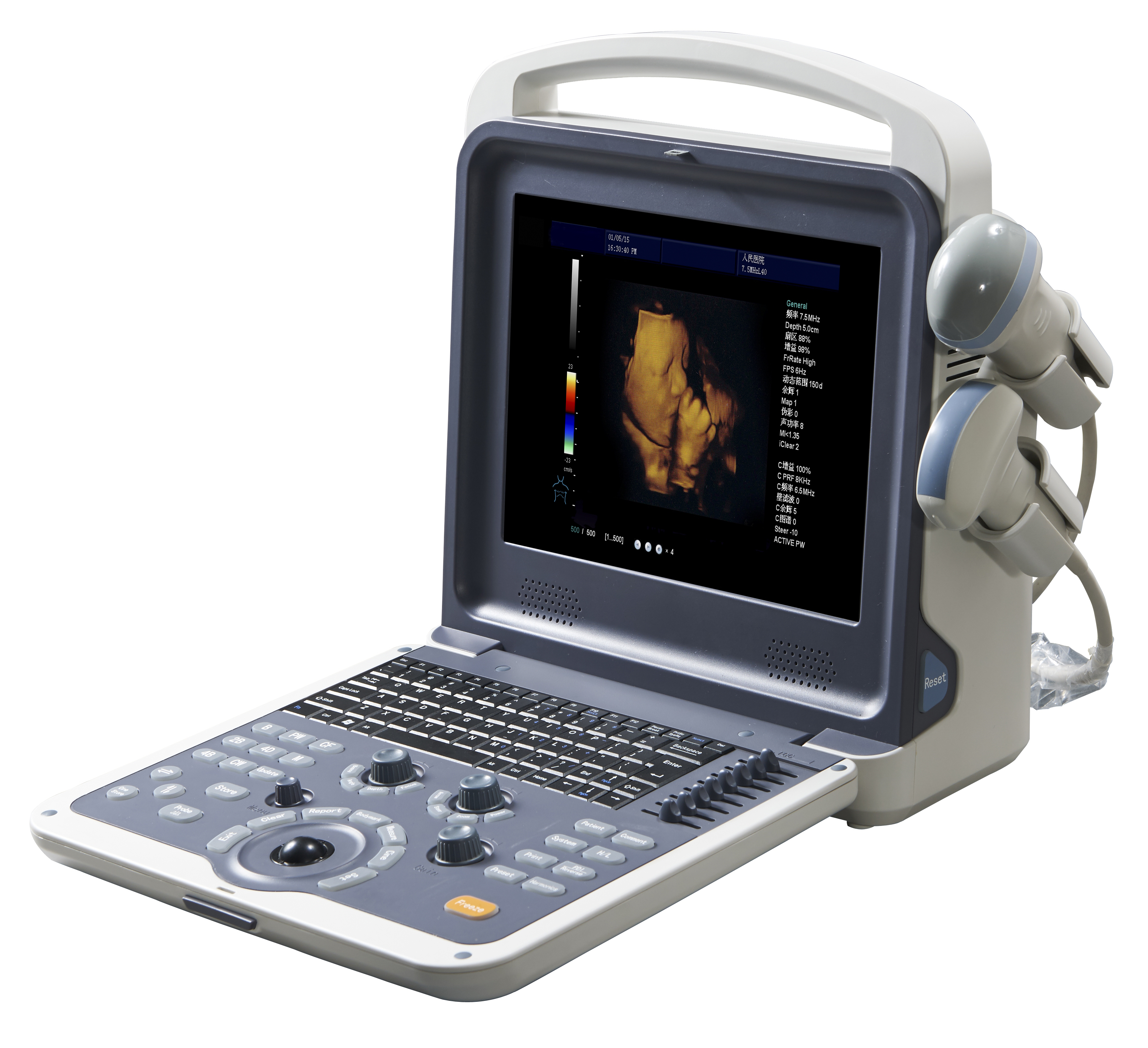 Full Digital Portable 4D Color Doppler Ultrasonic Diagnostic System