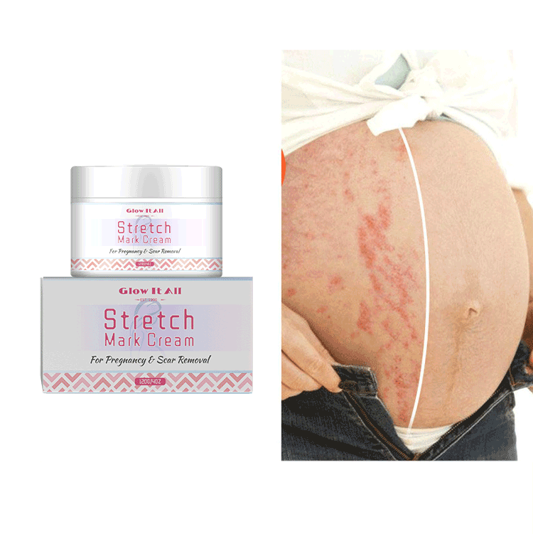 Amazon Hot Sale Stretch Mark set Skin care Anti Wrinkle Anti Aging Carboxytherapy For Stretch Marks treatment cream