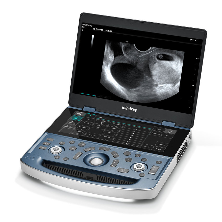 Mindray MX7 Portable Ultrasound System Medical Echocardiography 4d Color Doppler Ultrasound Machine