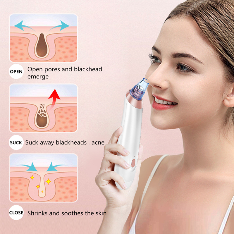 Good Price Factory Pore Cleanser Rechargeable Electric Handheld Facial Vacuum Suction Machine Home Use Vacuum Blackhead Remover