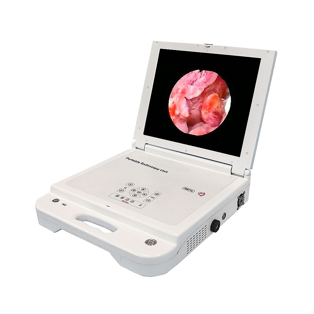 LTES44 New Products cheap price 17 Inches Portable CCD Endoscope Camera Unit For Hospital