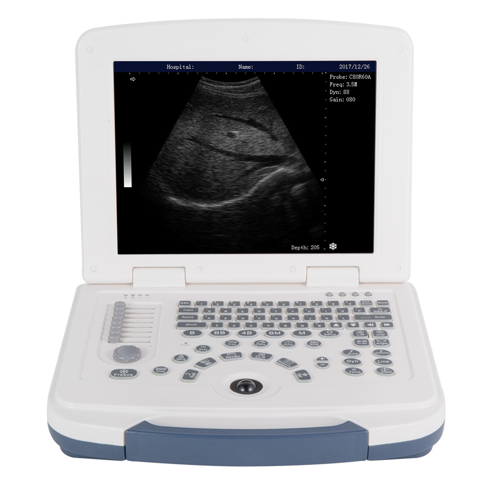 High Definition Multi-function Full-digital Real 80 Elements Laptop Ultrasonic Diagnostic Apparatus Machine