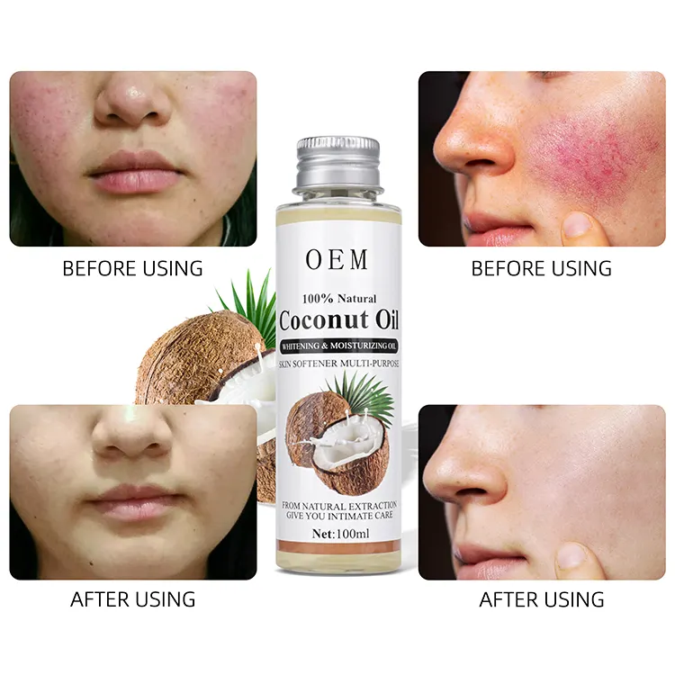 Private Label 100% Pure Crude Organic Cold Pressed Skin Massage Body Moisturizing Skin Care Rbd Bulk Virgin Coconut Oil