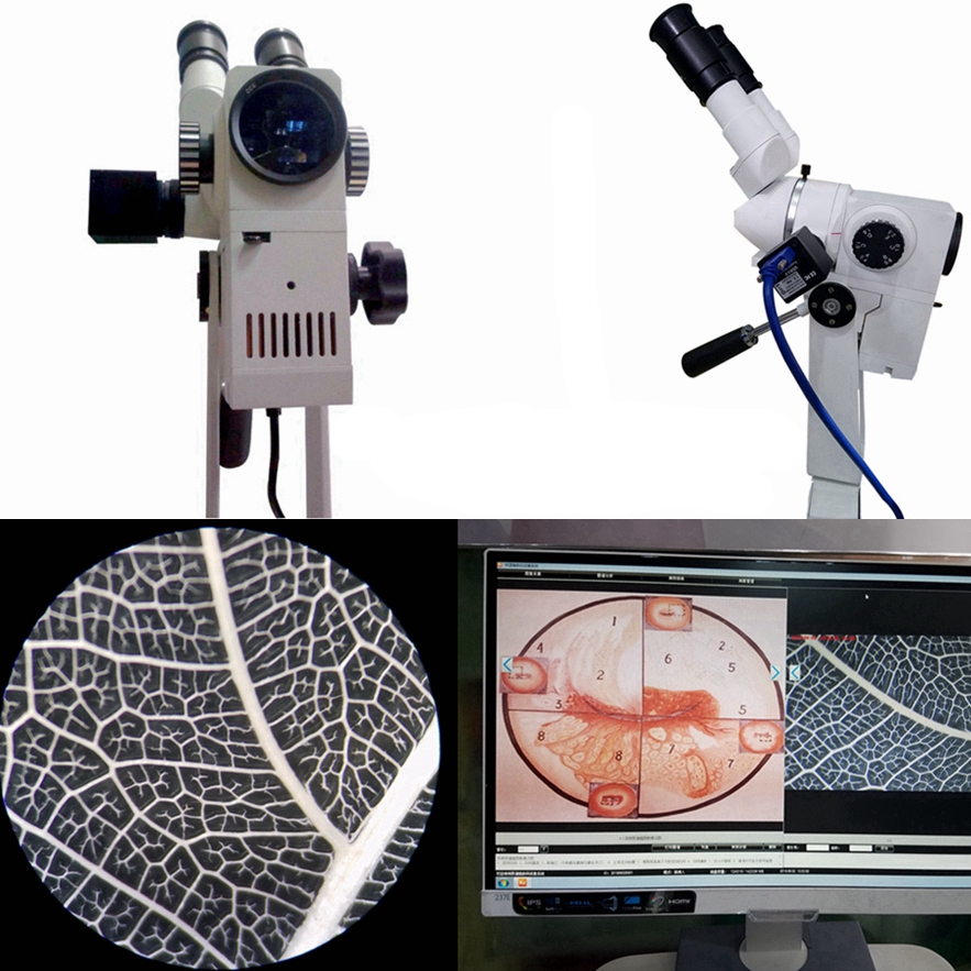 Kernel binocular HD Colposcope optical camera high end colposcope