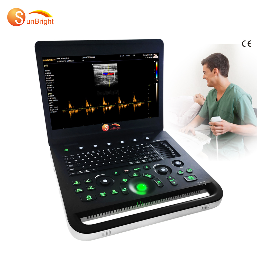 New arrival Medical equipment Professional color diagnostic ultrasound system
