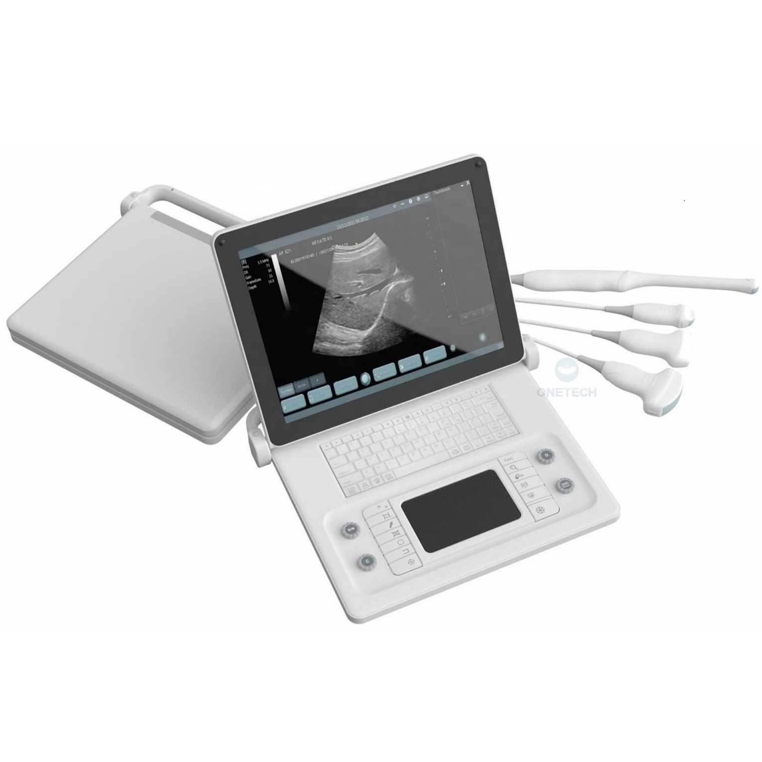 Best seller portable diagnostic ultrasound machine price in China medical exhibition / High intensity focused ultrasound B51