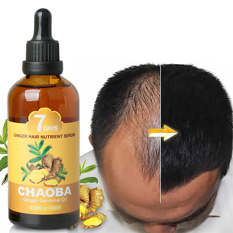 Wholesale 30ml Ginger Oil 7 Days Hair Growth Essential Oil For Hair Loss Treatment Regrowth Serum