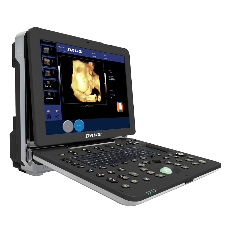 Medical Ultrasound Equipment Portable Ultrasound Machine Instruments 4D Color Doppler Ultrasound Machine for GYN
