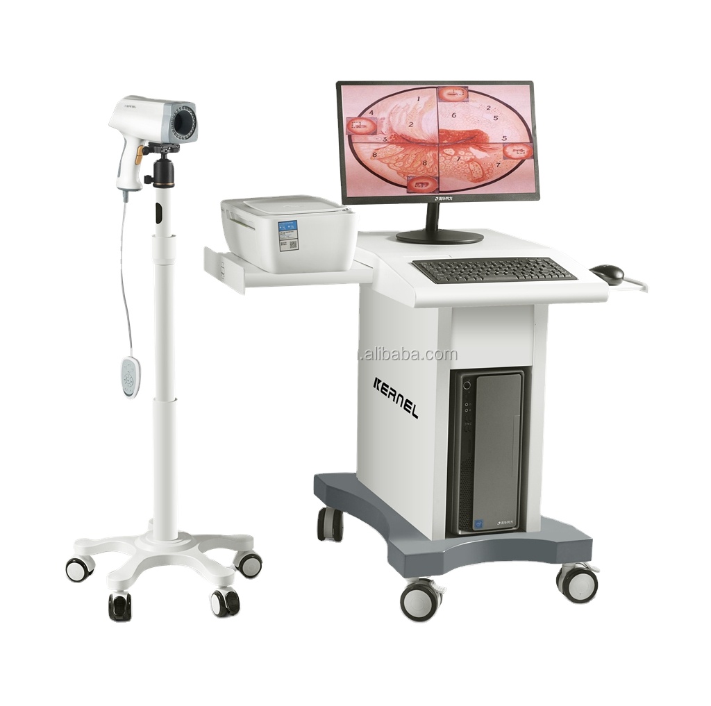 kn2200 UN 510K approved Women Portable Electronic Mini Colposcope High Quality Digital Video Colposcope
