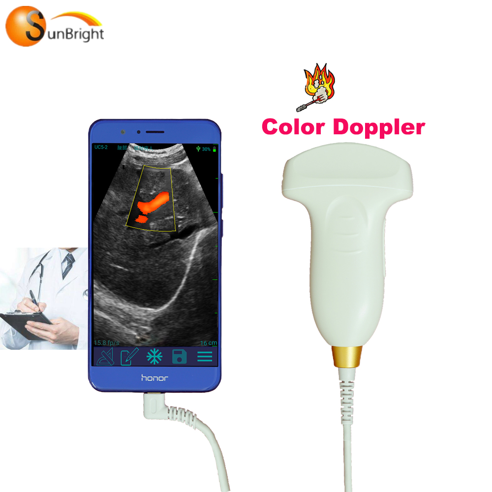 Выпуклая Кривая Датчик цвета doppler беспроводной usb ультразвуковой зонд цена