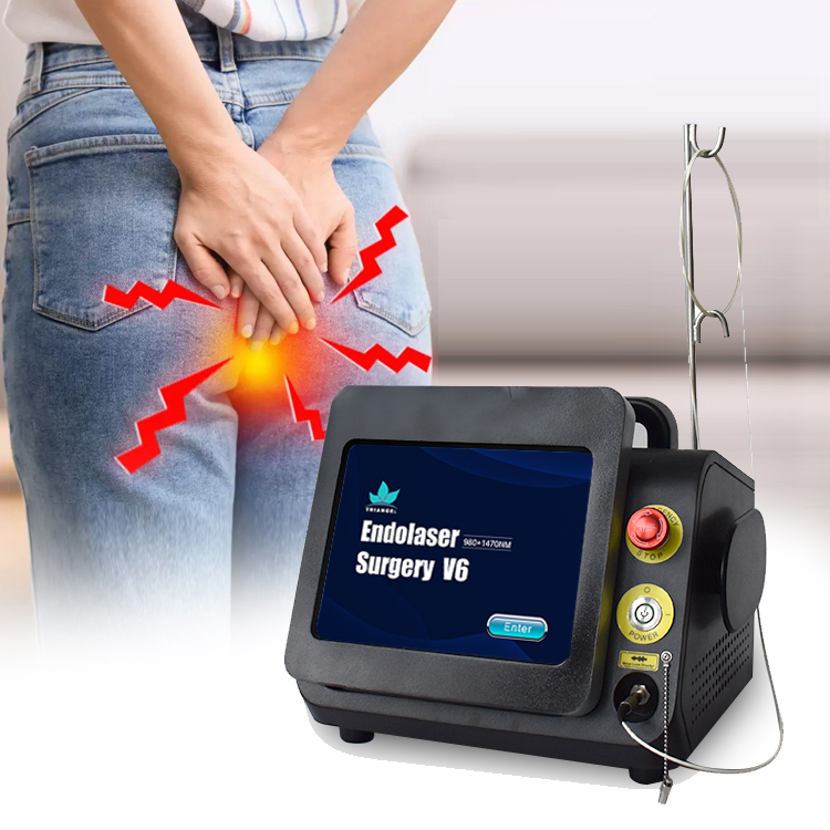 Professional anorectal fistula treatment laser equipment urology surgery