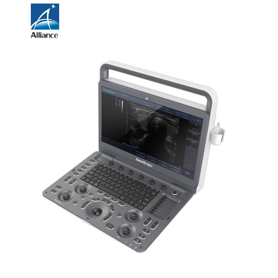 Sonoscape E1EXP 2D Portable Color Human Ultrasound Machine 15.6inch Screen 500GB Hard disk