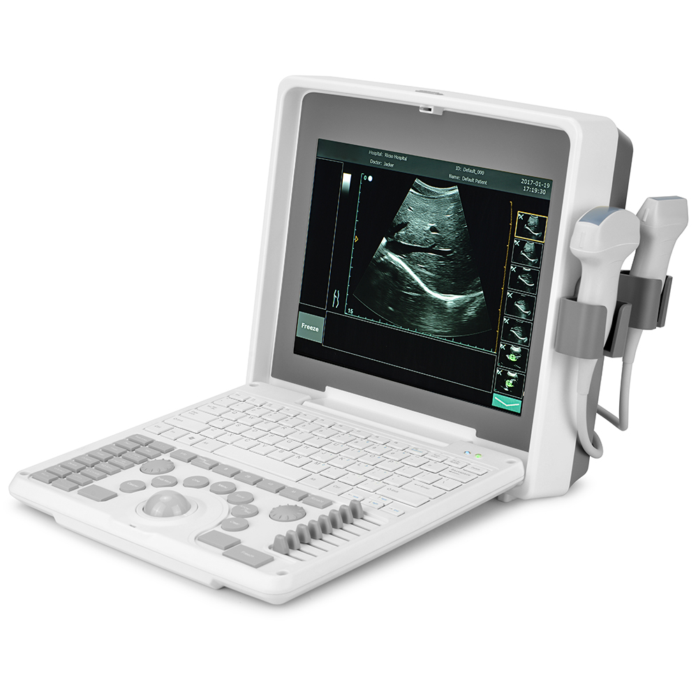 12.1" S990 Plus Handheld High Image Quality hospital clinic use Portable Ultrasound Machine ultrasound scanner